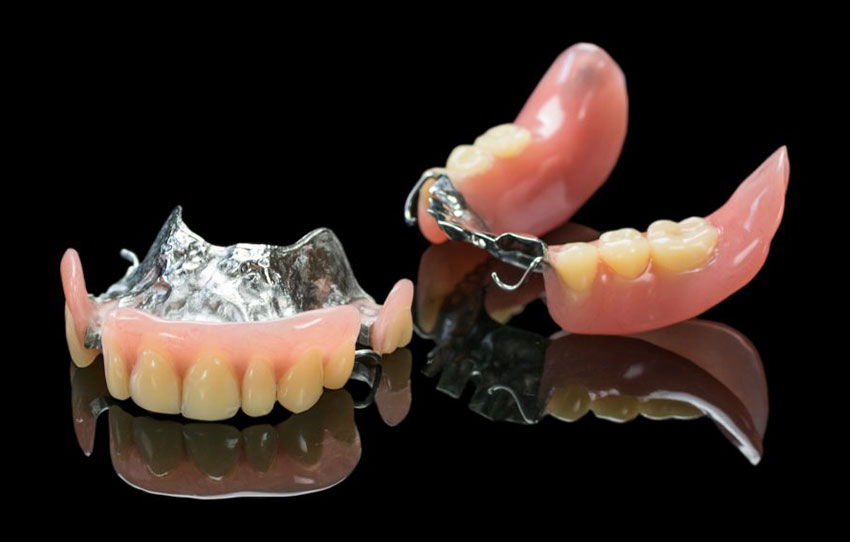 Definir Casi muerto Coincidencia Clínica Dental Bejerano - Rehabilitación mediante prótesis removibles